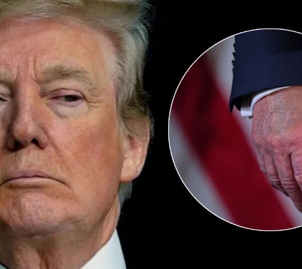 Donald Trump se somete a chequeo médico por hinchazón en las piernas causada por insuficiencia venosa. Foto: cronista