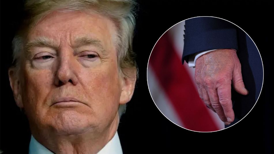 Donald Trump se somete a chequeo médico por hinchazón en las piernas causada por insuficiencia venosa. Foto: cronista