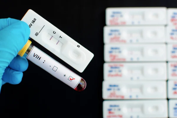 Puebla registra descenso en muertes por SIDA