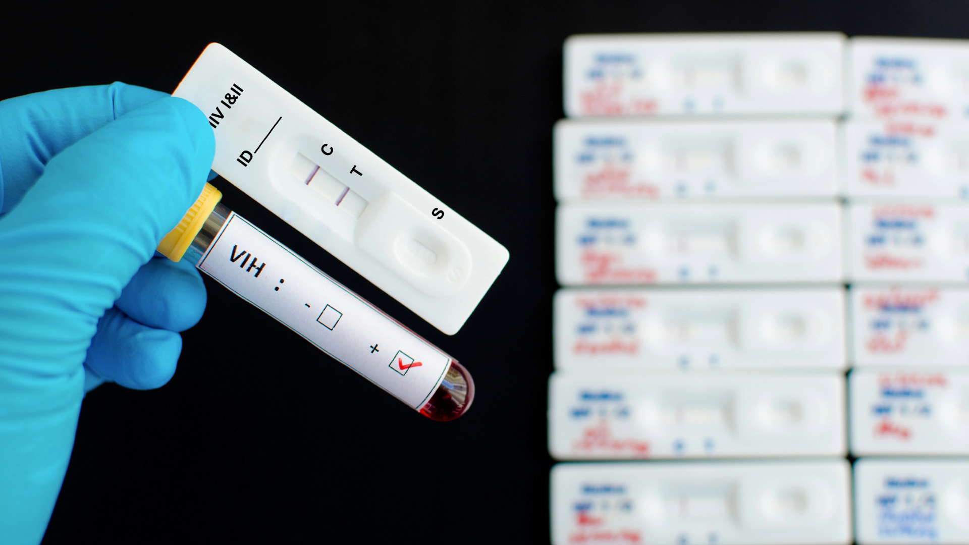 Puebla reduce muertes por SIDA pero mantiene 770 nuevos casos en 2025