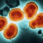 México confirma su primer caso de influenza A H3N2 subclado K; el paciente ya está recuperado, pero Salud pide reforzar la vacunación invernal. IMAGEN: N+.