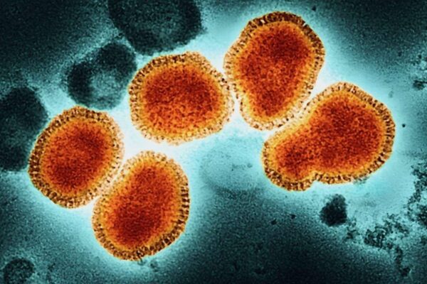 México confirma su primer caso de influenza A H3N2 subclado K; el paciente ya está recuperado, pero Salud pide reforzar la vacunación invernal. IMAGEN: N+.