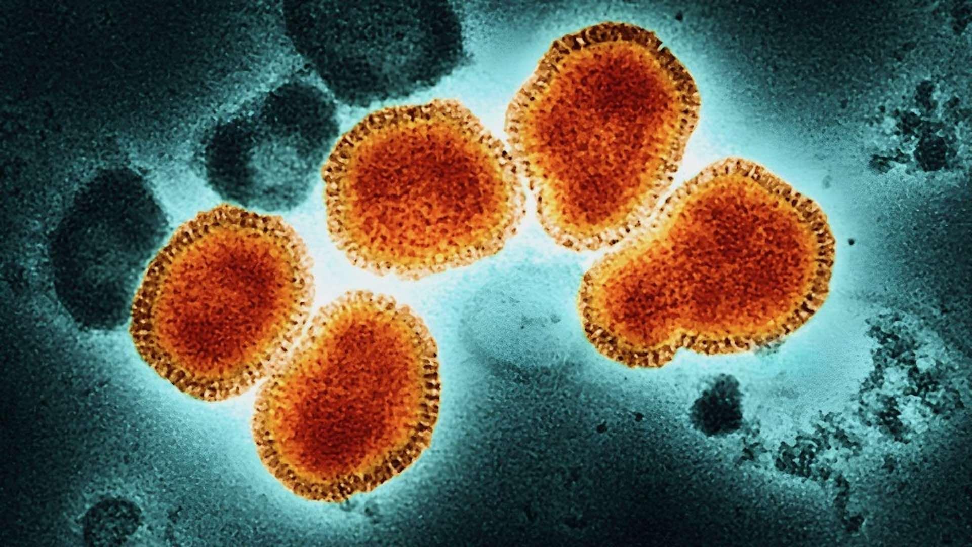 México registra su primer caso de influenza A H3N2 subclado K; Salud descarta riesgo elevado y pide reforzar vacunación