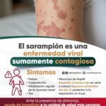 El Ayuntamiento de Texmelucan llamó a la población a reforzar medidas de prevención sanitaria tras un nuevo caso de sarampión en Puebla.