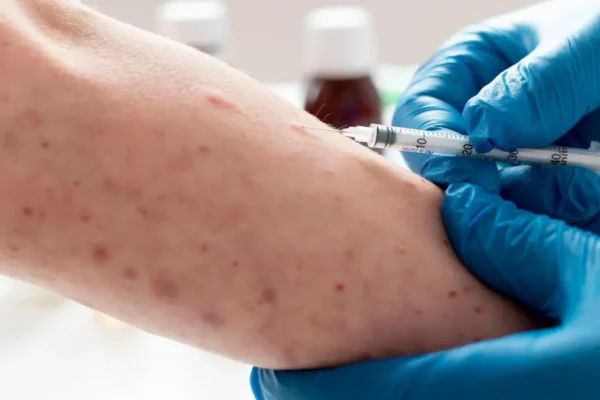 Ante el reporte de casos de sarampión en la zona del Mercado Hidalgo, mañana jueves habrá jornada de vacunación en el lugar. FOTO: Consultor Salud.