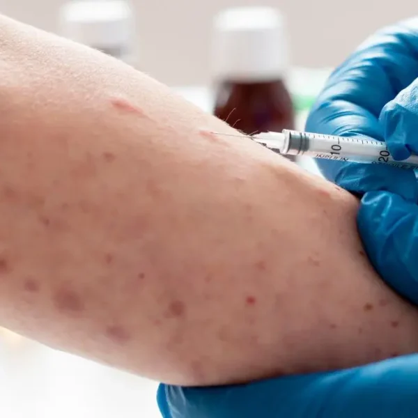 Ante el reporte de casos de sarampión en la zona del Mercado Hidalgo, mañana jueves habrá jornada de vacunación en el lugar. FOTO: Consultor Salud.