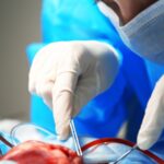 Más de 2 mil pacientes en Puebla esperan un trasplante. FOTO: Integralab.