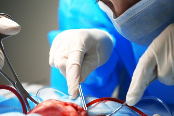 Más de 2 mil pacientes en Puebla esperan un trasplante. FOTO: Integralab.