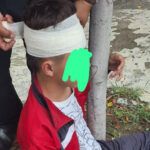 SEP investiga agresión a estudiante de bachillerato en Atlixco ante acusaciones de omisión directiva Hospitalizan a estudiante tras golpiza en bachillerato de Atlixco; acusan fallas en seguridad.