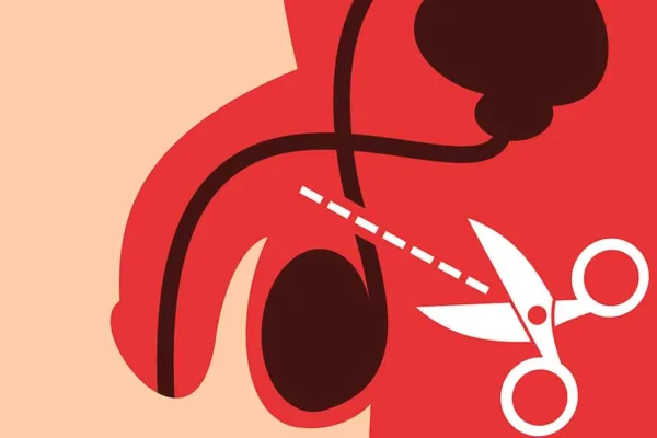 Por el Día del Padre, habrá cirugías de vasectomía sin bisturí en siete unidades del IMSS Puebla. ILUSTRACIÓN: Selecciones.com
