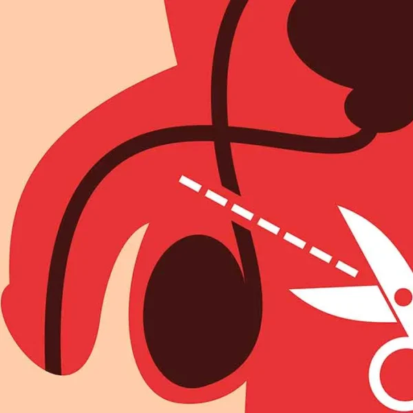 Por el Día del Padre, habrá cirugías de vasectomía sin bisturí en siete unidades del IMSS Puebla. ILUSTRACIÓN: Selecciones.com